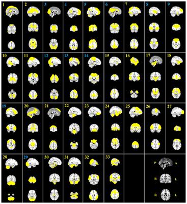 Functional Connectivity of Child and Adolescent Attention Deficit Hyperactivity Disorder Patients: Correlation with IQ